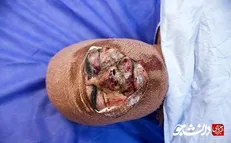 مواد محترقه از اول اسفند ۱۴ مصدوم برجای گذاشته است