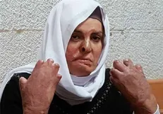 حبس زن اسیر فلسطینی با ۵۰ درصد سوختگی