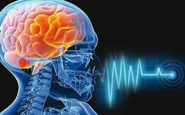 سکته مغزی ۱۰ سال زودتر در کمین ایرانیان/ ابتلا به سکته مغزی در ایران ۱.۵ برابر متوسط جهانی