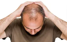 ریزش مو را با این ترفند‌ها سریع متوقف کنید