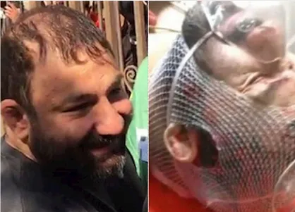 آخرین وضعیت جسمی &laquo;هانی کُرده&raquo; از اراذل و اوباش تهران