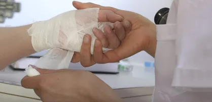 تبعات آسیب&zwnj;های سوختگی الکتریکی/ ضرورت ایمن سازی محیط کار