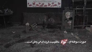 صورت سوخته او، گواه مظلومیت فرزندان این وطن است