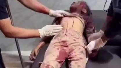 شهادت و زخمی شدن کودکان در حمله رژیم صهیونیستی به مدرسه&zwnj;ای در مرکز نوار غزه