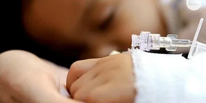 ابتلای ۶۰۰ کودک به سندرم التهابی مرتبط با کرونا