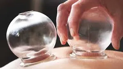 بادکش درمانی چیست و چه کاربرد&zwnj;هایی دارد؟