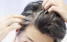 استرس باعث خاکستری شدن مو می‌شود