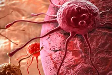 تشخیص زودهنگام سرطان تخمدان تنها از طریق نمونه خون ممکن شد