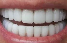 دندان با چه ماده اى پرمى شود؟
