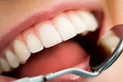 بیمه دندانپزشکی، کارت تخفیف دندانپزشکی