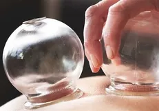 اثر درمانی حجامت را با رعایت این تدابیر چند برابر کنید