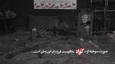 صورت سوخته او، گواه مظلومیت فرزندان این وطن است