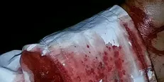 حمله به ۲ طلبه نیشابوری با چاقو/ ضاربان آزاد در محله می‌چرخند؛ خبری از دستگیری نیست