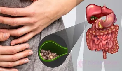 علائم کیسه صفرا چیست و از کجا بفهمیم سنگ کیسه صفرا داریم؟