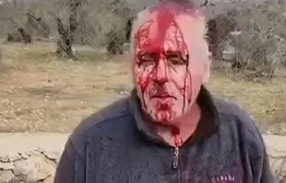 حمله شهرک&zwnj;نشینان صهیونیستی به فلسطینیان در شرق رام&zwnj;الله