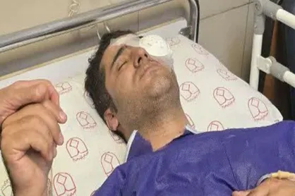تشخیص وضعیت بینایی محیط&zwnj;بان آسیب دیده اصفهانی تا ۱۰ روز دیگر