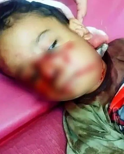 حادثه دلخراش در شوش / سگ مهاجم جان کودک ۴ ساله را تهدید کرد!