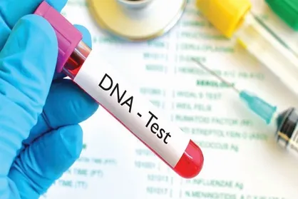 ضرورت ایجاد امکان انجام آزمایش DNA در جنوب استان کرمان
