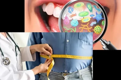میکروب&zwnj;های دهان می&zwnj;توانند کلید پیشگیری از چاقی باشند