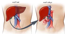 ماجرای فروش کبد ۵۰۰ میلیونی در پایتخت/ شرایط پیوند کبد زنده به زنده