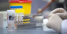 تأیید داروی ایرانی برای التهاب ریه مبتلایان کرونا
