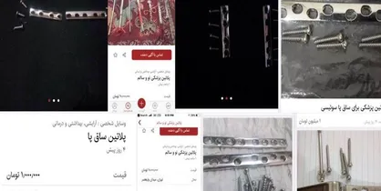 دومین کنگره بین المللی قلب و عروق ایران و اروپا آغاز شد