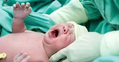 موشن گرافیک &laquo;سزارین دشمن جمعیت&raquo;