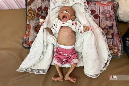 تراژدی قحطی در نوار غزه