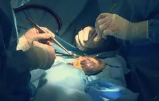 تاثیر مثبت سلول بنیادی مزانشیمی مغز استخوان بر بهبود ضایعات قلبی