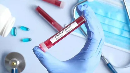 کیت&zwnj;هایی برای استخراج RNA از بیماران مبتلا به کرونا عرضه تجاری می&zwnj;شود