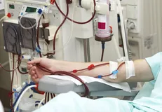 دیالیز با کمک فناوری نانو سریع‌تر انجام خواهد شد