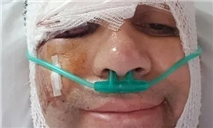 &laquo;امیر کربلایی&zwnj;زاده&raquo; از بیمارستان مرخص شد
