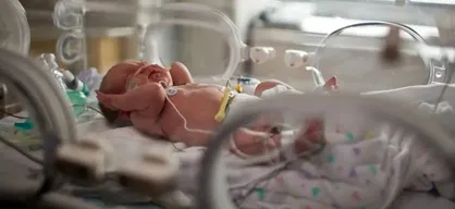 کاهش مرگ&zwnj;ومیر نوزادان با تقویت NICU در بیمارستان امام سجاد یاسوج